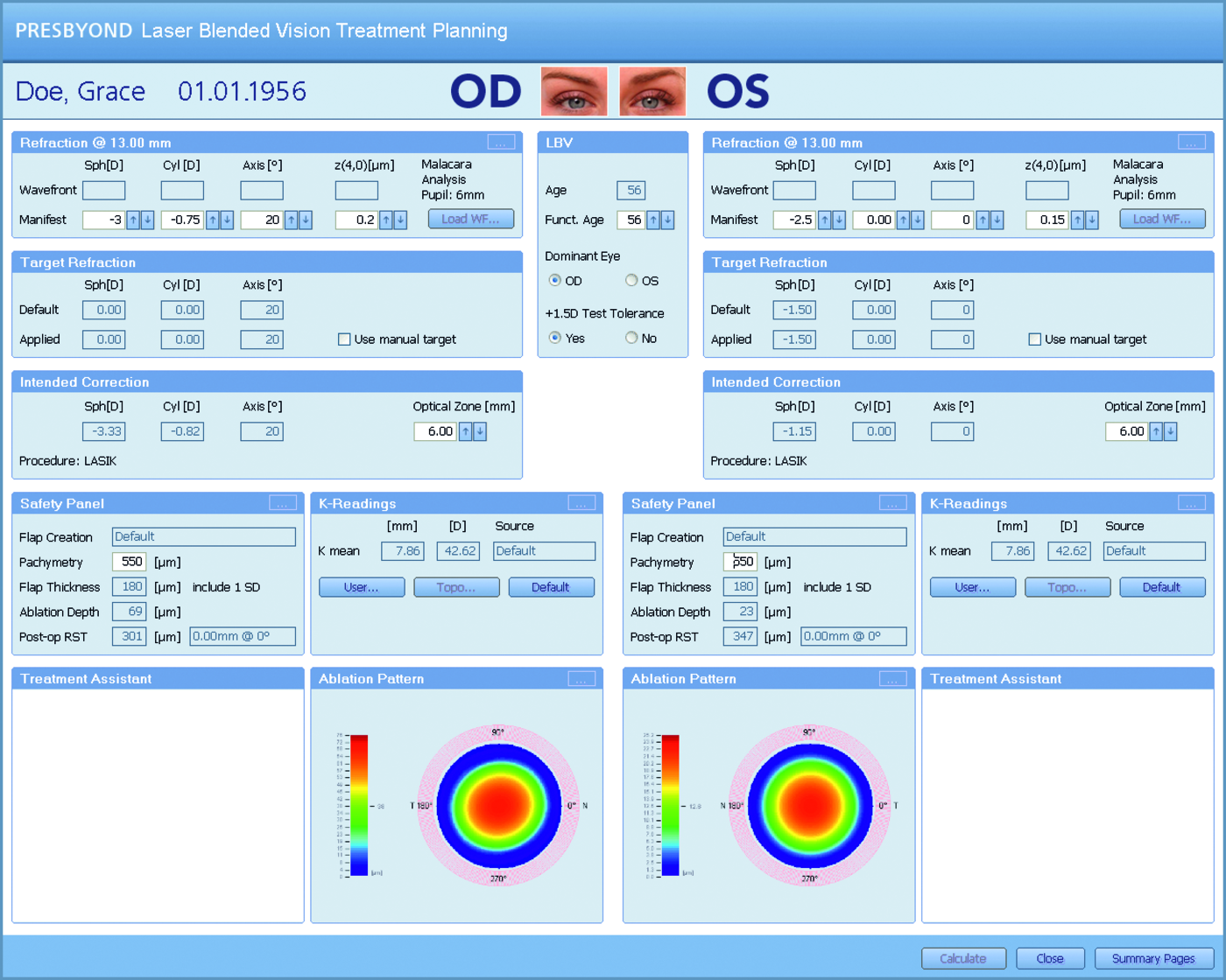 PRESBYOND treatment parameter EN (med-zoom)